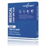 Blue Inkjet Xray Film | Size 10"×12" | Qty. 100 Films